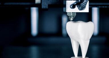 Study highlights benefits of in-house 3D printing for immediate dental implant placement