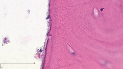 Laser in chirurgia orale e medicina