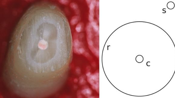 Les dentistes sujets à une illusion d’optique