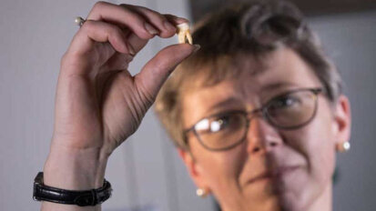 Pierwsze stałe zęby trzonowe są bazą danych zdrowia sprzed czasów porodowych