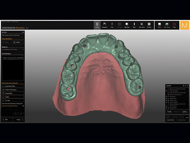 Přehled různých výsledků podle použitých abutmentů.