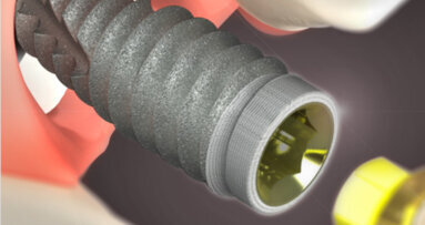 BioHorizons grants gift to NYU Dentistry to expand access, education for implant dentistry