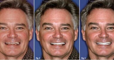 Un nouveau sourire, nouvelle vie : les technologies et techniques novatrices peuvent transformer un sourire