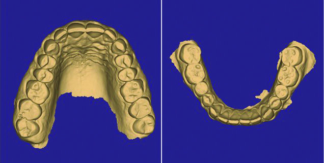 Fig. 2b_Visione occlusale: file .STL.