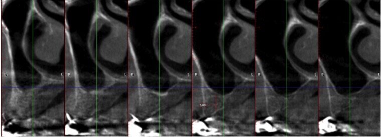 Fig. 3- Cross section di zona 24.