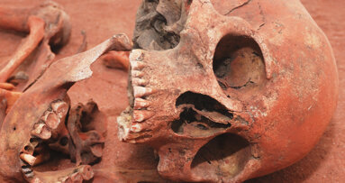 Une flore bactérienne plus riche protégeait nos ancêtres de la carie dentaire