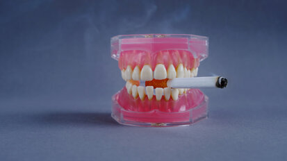 Uticaj elektronskih cigareta, cigareta, vodene lule i bezdimnog duvana na zubne implantate