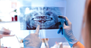 Study shows dentists may underdiagnose when under time pressure