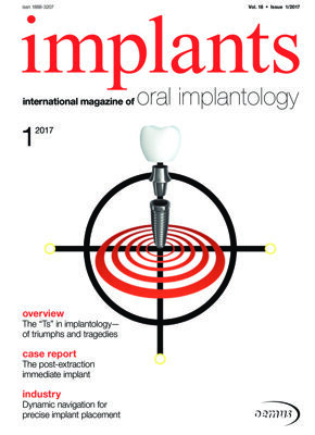 implants international No. 1, 2017 implants international No. 1, 2017