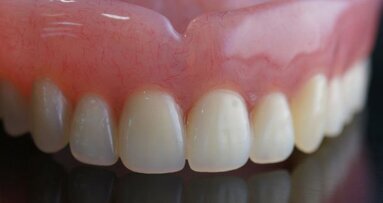 Nouvelle étude sur la qualité de vie des patients porteurs de prothèses et d’implants dentaires