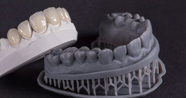 Predictability of the CAD/CAM workflow in today’s aesthetic cases