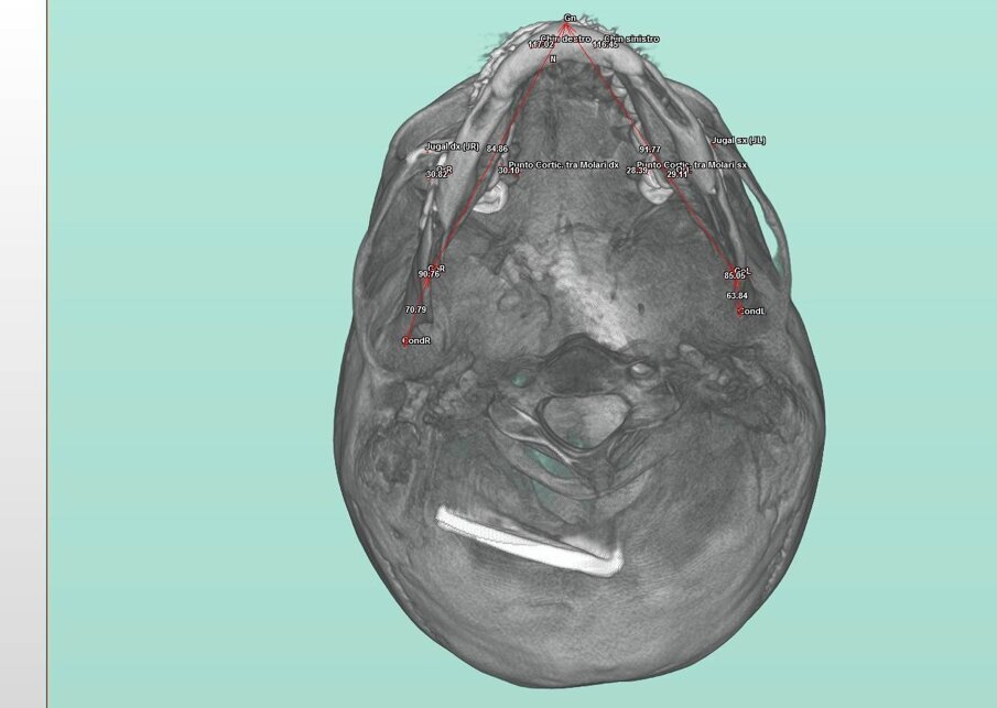 Fig. 6_Visione assiale.