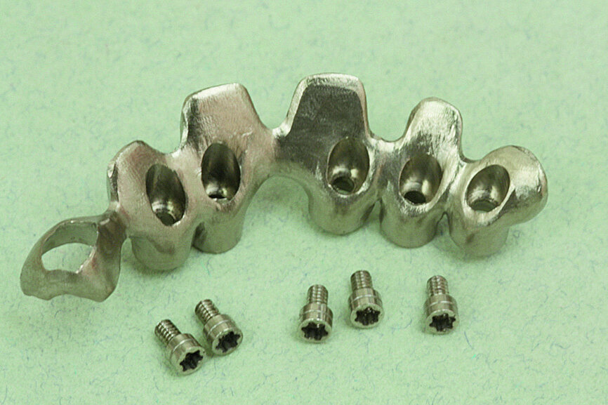 Fig. 25: Testing of the titanium framework on the working model and verifi cation of stability.