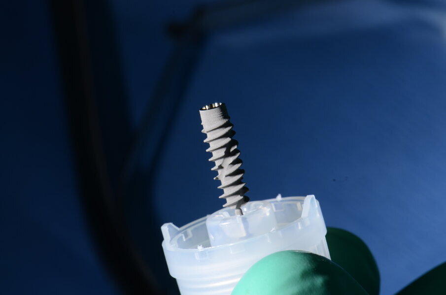 Fig. 26 - Impianto BLX Straumann.