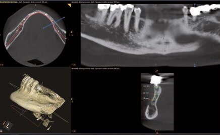 Fig. 2 - Misurazioni in sede 35.