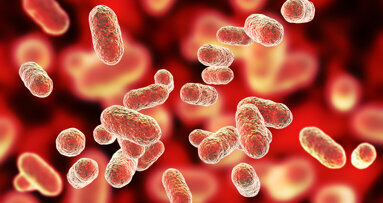 Periodontal disease and coronary artery disease share genetic basis