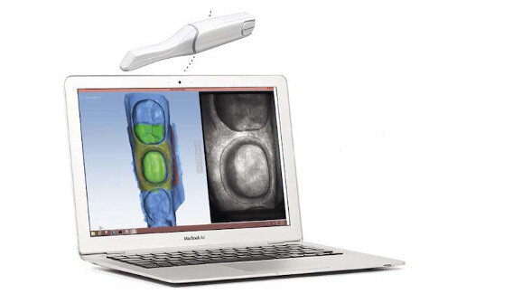 Planmeca ofrece desde tomógrafos a CAD/CAM