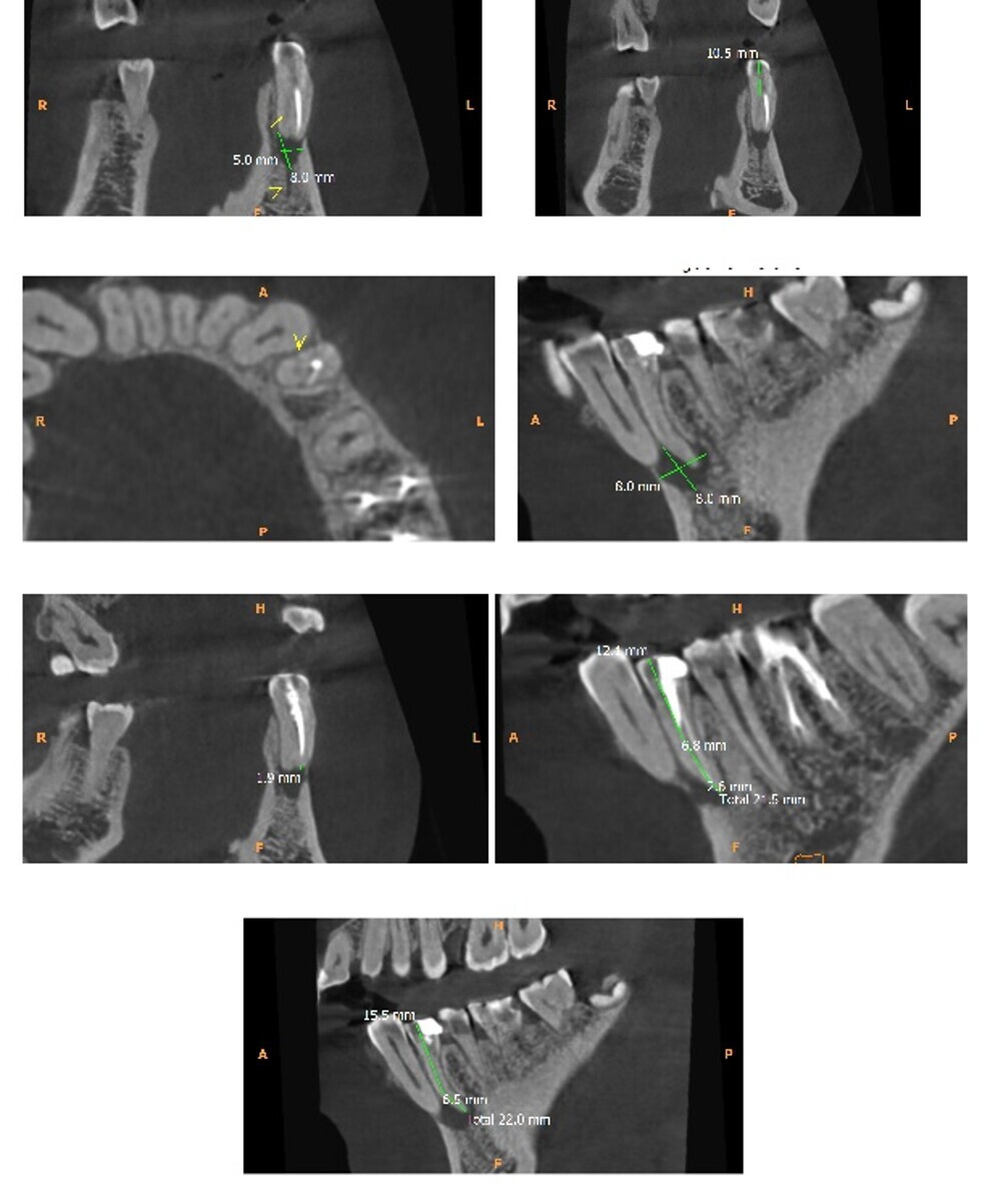 Fig 3. Scan sections