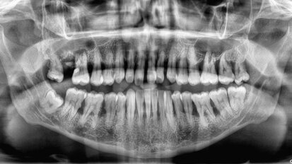 Do our patients know the value of a tooth?