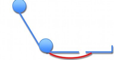 Trois bonnes raisons d’allonger son patient - Leçon 4