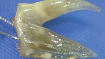 Transparentne zęby – skuteczna pomoc edukacyjna