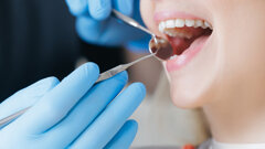 FVDZ fordert zum Weltmundgesundheitstag stärkere Prävention