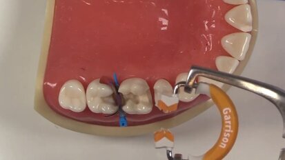 The Correct Ring Saves You Finishing Time