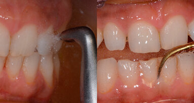 L’igienista dentale? Null’altro che il “dental coach” del paziente