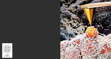 Uni Basel: Brustkrebs auf der Spur