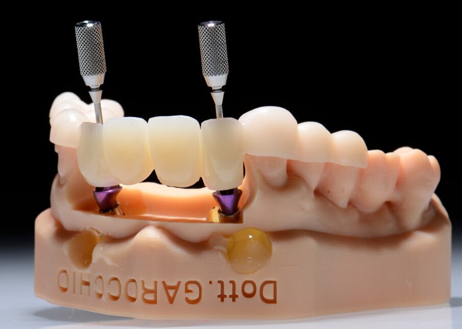 Fig. 47 - Provvisorio e SRA.