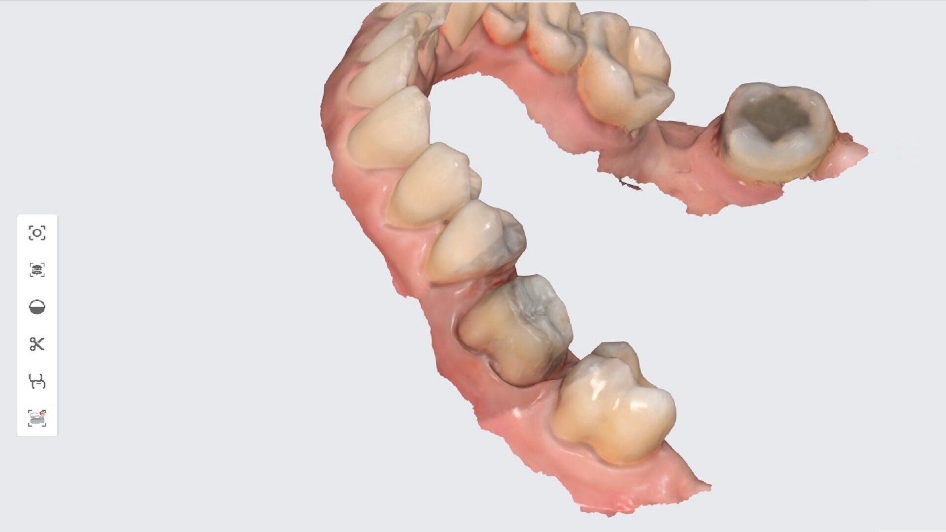 3D printing in dentistry: The secret to offering more for less