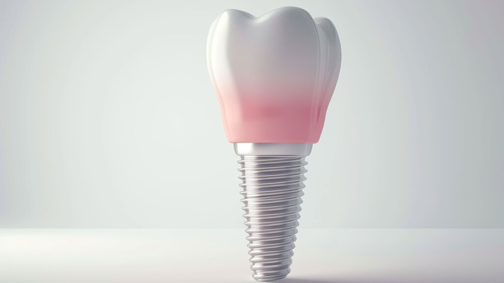 Neue S3-Leitlinie zum Thema Keramikimplantate