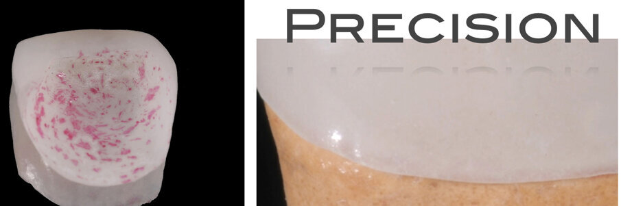 Fig. 24 - Precisione marginale dell’impiallacciatura fissata sulla matrice master.