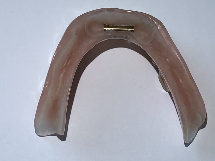 Afbeelding 4. Secundaire deel van staaf in de prothese.