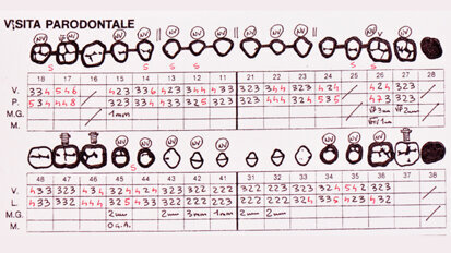 Riabilitazione complessa protesico-parodontale