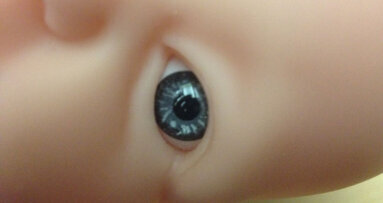 Little progress recorded in historical cleft lip and palate treatment