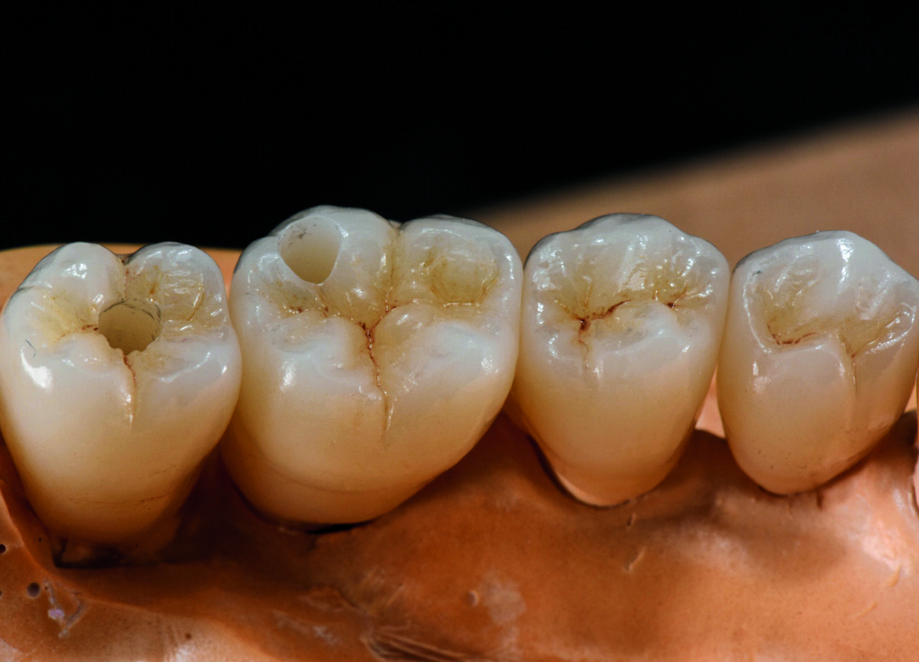 Fig. 8a : Dernières touches de colorants et de glaçures qui ont permis l’obtention d’un brillant naturel. 