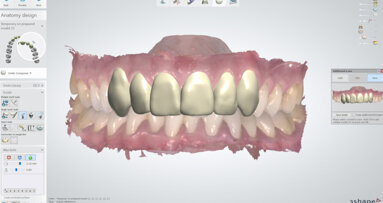 Dentsply Sirona and 3Shape expand their strategic partnership