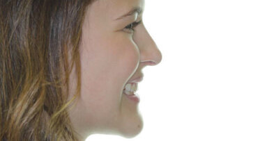 Estetika je budoucnost ortodoncie