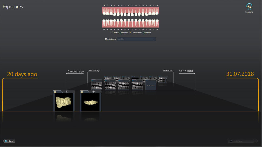 Meeting users’ needs: Dentsply Sirona releases Sidexis 4 V 4.3 and updates Orthophos SL