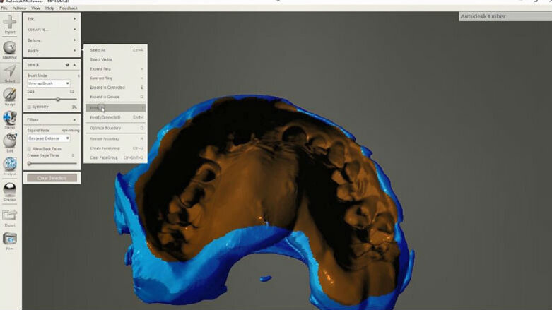 Uso di materiali da impronta radiopachi per ottenere file 3D