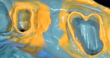 Wycisk, jako ważny etap procedury klinicznej – raport użytkownika