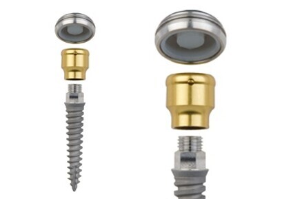 LODI (Locator Overdenture Implant System)