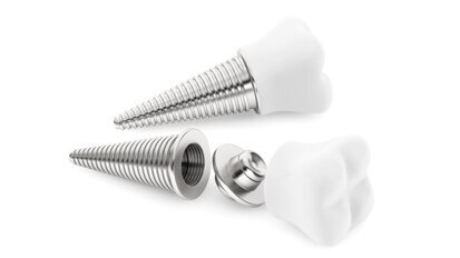 Mikrogewinde an Implantaten begünstigen Osseointegration Mikrogewinde an Implantaten begünstigen Osseointegration