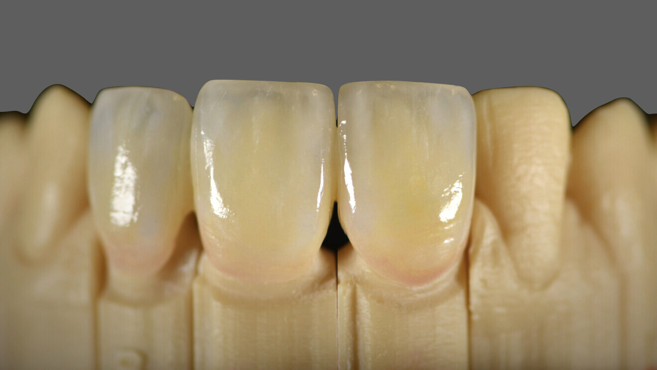 Fig. 4 : Résultat après étude colorimétrique.
