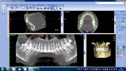 Para el mejor diagnóstico, utilice el mejor software