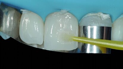 Bio-esthétique : donner un visage nouveau à l’amélioration du sourire