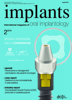 implants Italy No. 2, 2016 implants Italy No. 2, 2016