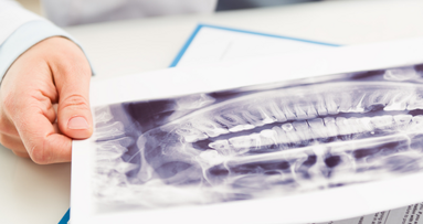 KZBV fordert unbürokratische Versorgung der Flüchtlinge