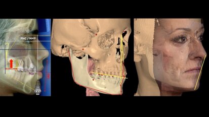Reivindicación de la Cefalometría